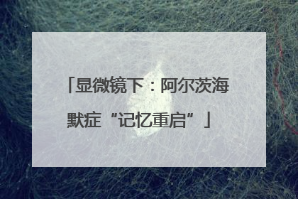显微镜下：阿尔茨海默症“记忆重启”