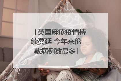 英国麻疹疫情持续蔓延 今年来伦敦病例数最多